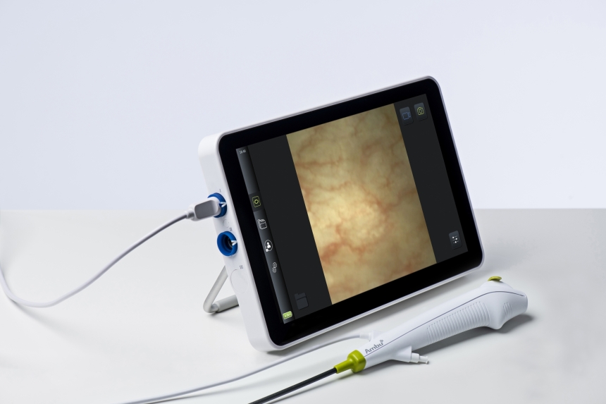 aView-2-Advance-and-aScope-4-Cysto-on-table-recording